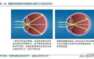 什么是特殊角膜接触镜，什么是特殊角膜接触镜的作用