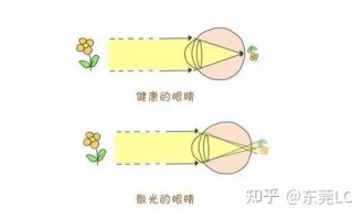 散光需要什么，散光需要什么镜片