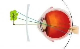 功能性镜片有什么，功能性镜片有什么好处