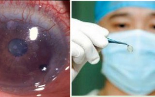 隐形眼镜怎么算使用周期，隐形眼镜怎么算使用周期的