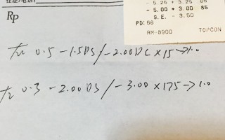 近视轴位多少，近视轴位多少为正常范围