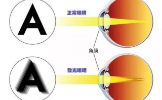 散光片隐形眼镜多少钱，散光片隐形眼镜多少钱一副